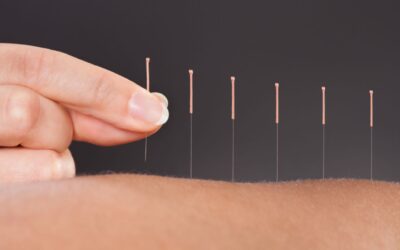 The Use of Acupuncture To Treat Osteoarthritis